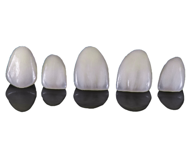 Porcelain Veneers